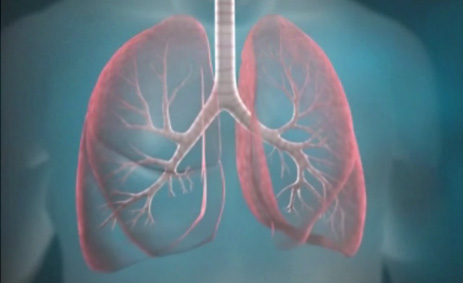 Inovação no tratamento da asma severa