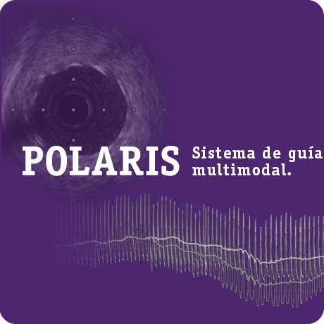 POLARIS Guidance System