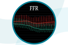 FFR