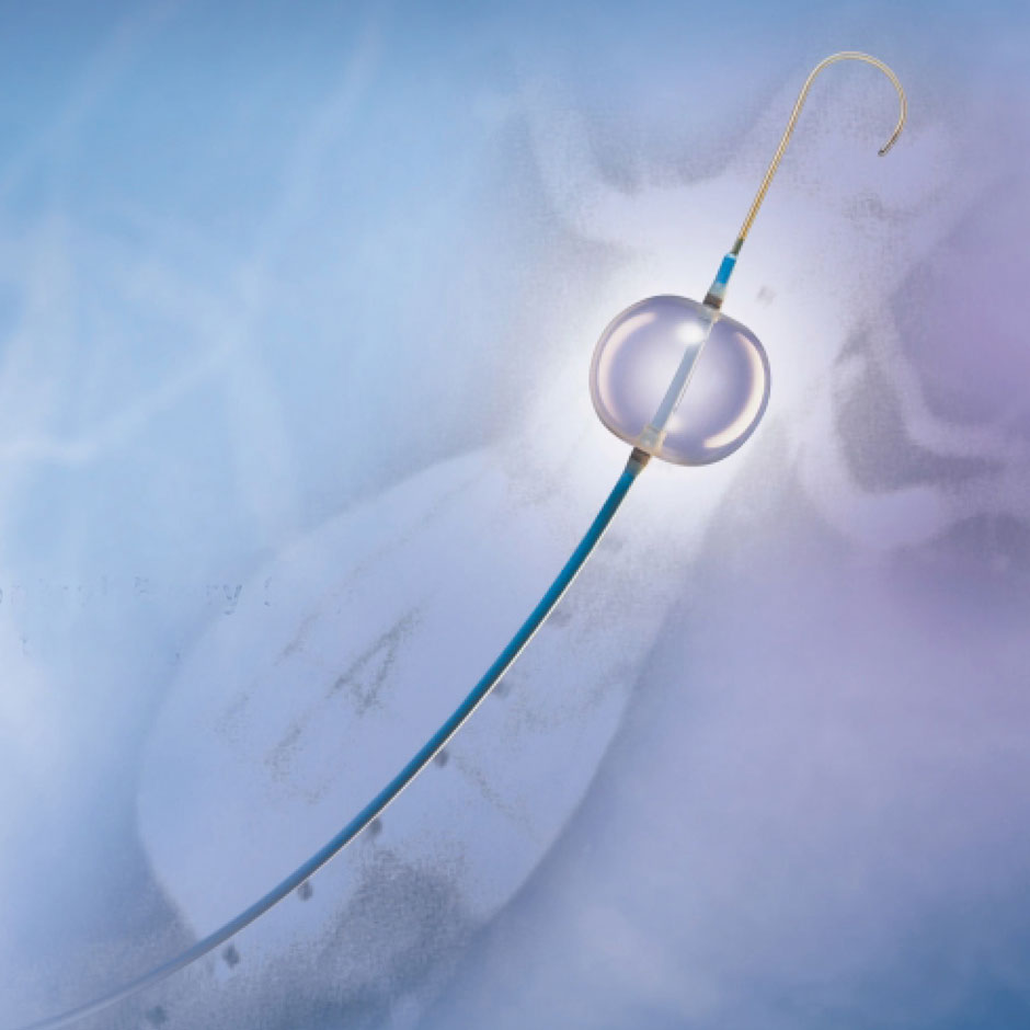 Equalizer™ Occlusion Balloon Catheter 
