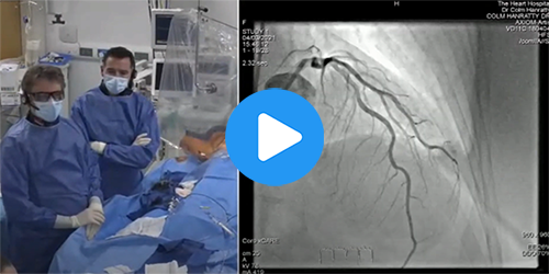 - Prof Robert Byrne & Dr Colm Hanratty: Live Case #2 from Mater Private Hospital, Dublin