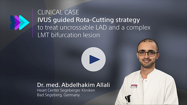 Dr. med. Abdelhakim Allali presents an IVUS guided Rota-Cutting strategy to treat an uncrossable LAD and a complex LMT bifurcation lesion. 
