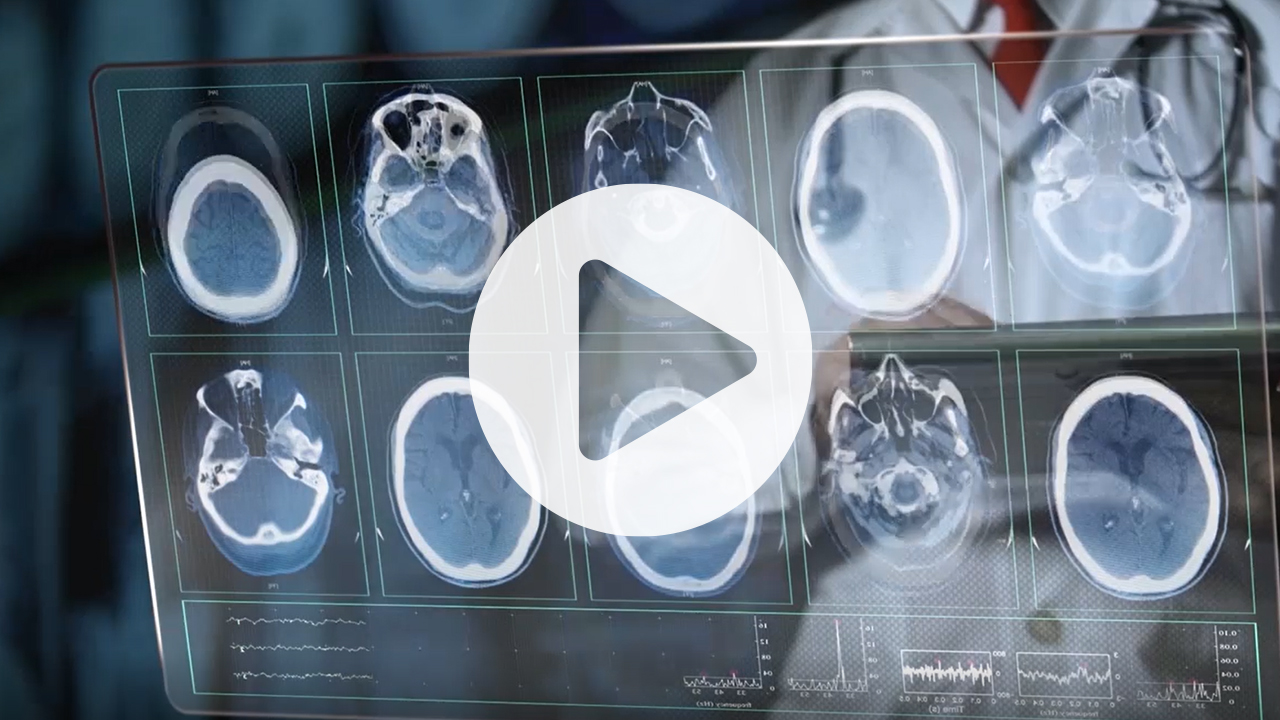 HealthReveal Vision Video