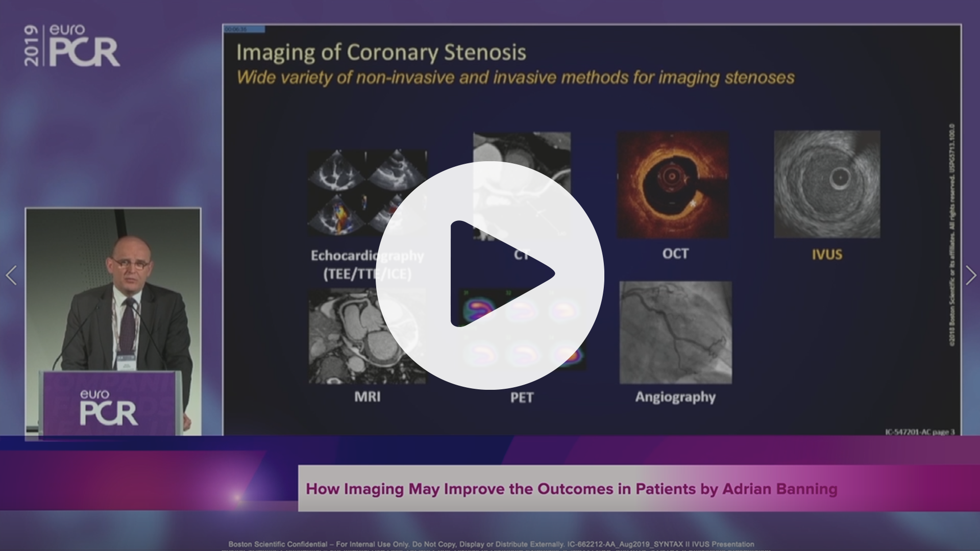 SYNTAX II How Imaging May Improve the Outcomes in Patients by Adrian Banning, VIdeo