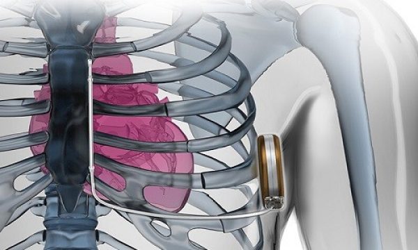 Electrophysiology | Boston Scientific