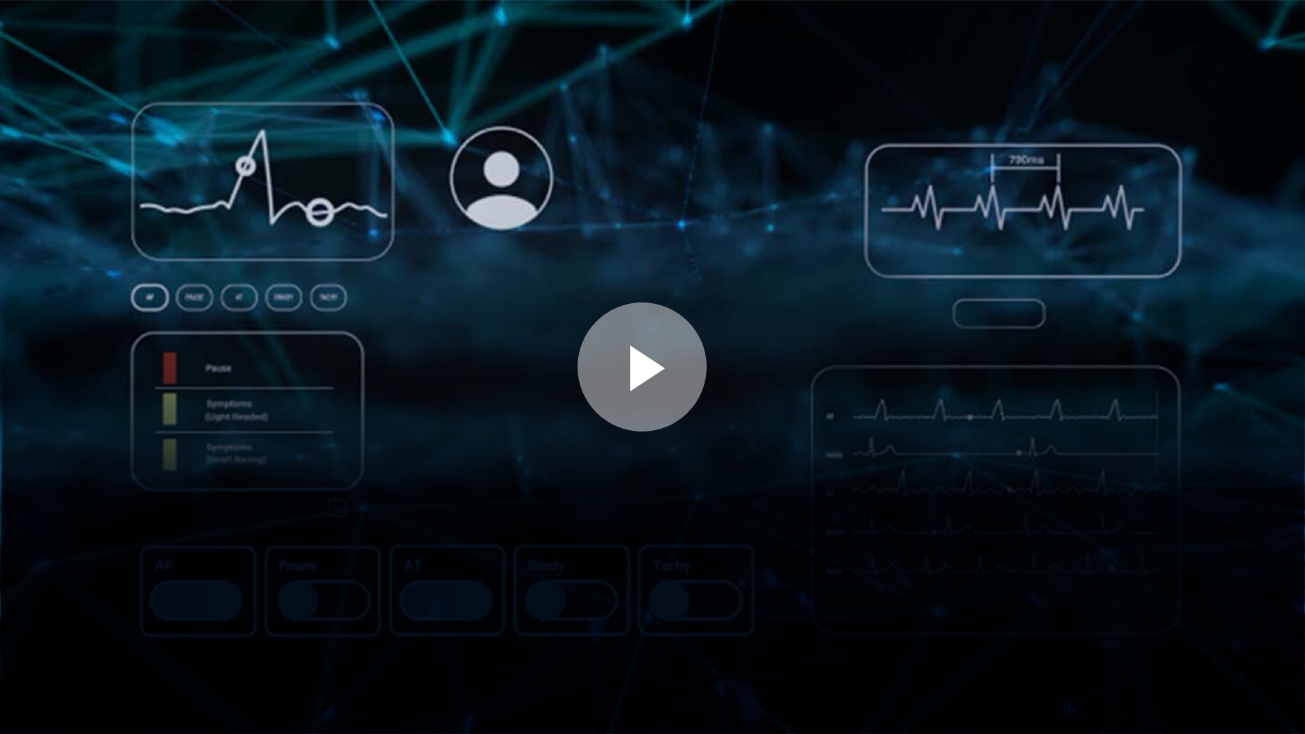 Video image with "Actionable insights. Fast diagnosis. Find out how the LUX-Dx ICM dual-stage algorithm rejects false positives to maximize your time. Plus, see performance results across multiple cardiac arrythmias."