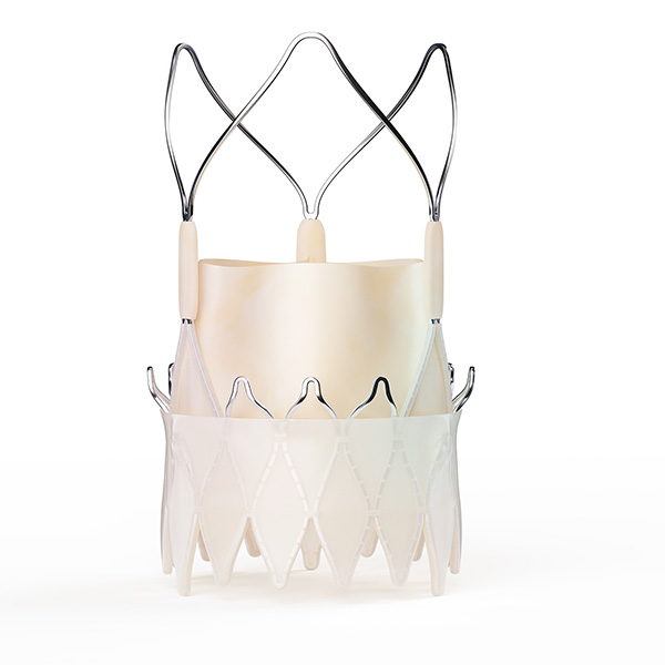 TAVI with the ACURATE neo2™ Aortic Valve System