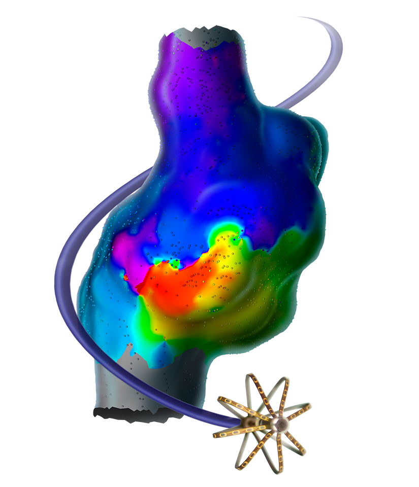 Rhythmia Cardiac Ablation Mapping System Boston Scientific