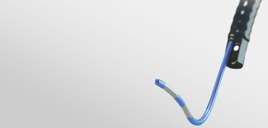 Radiofrequency (RF) Ablation Catheter cleared in U.S.