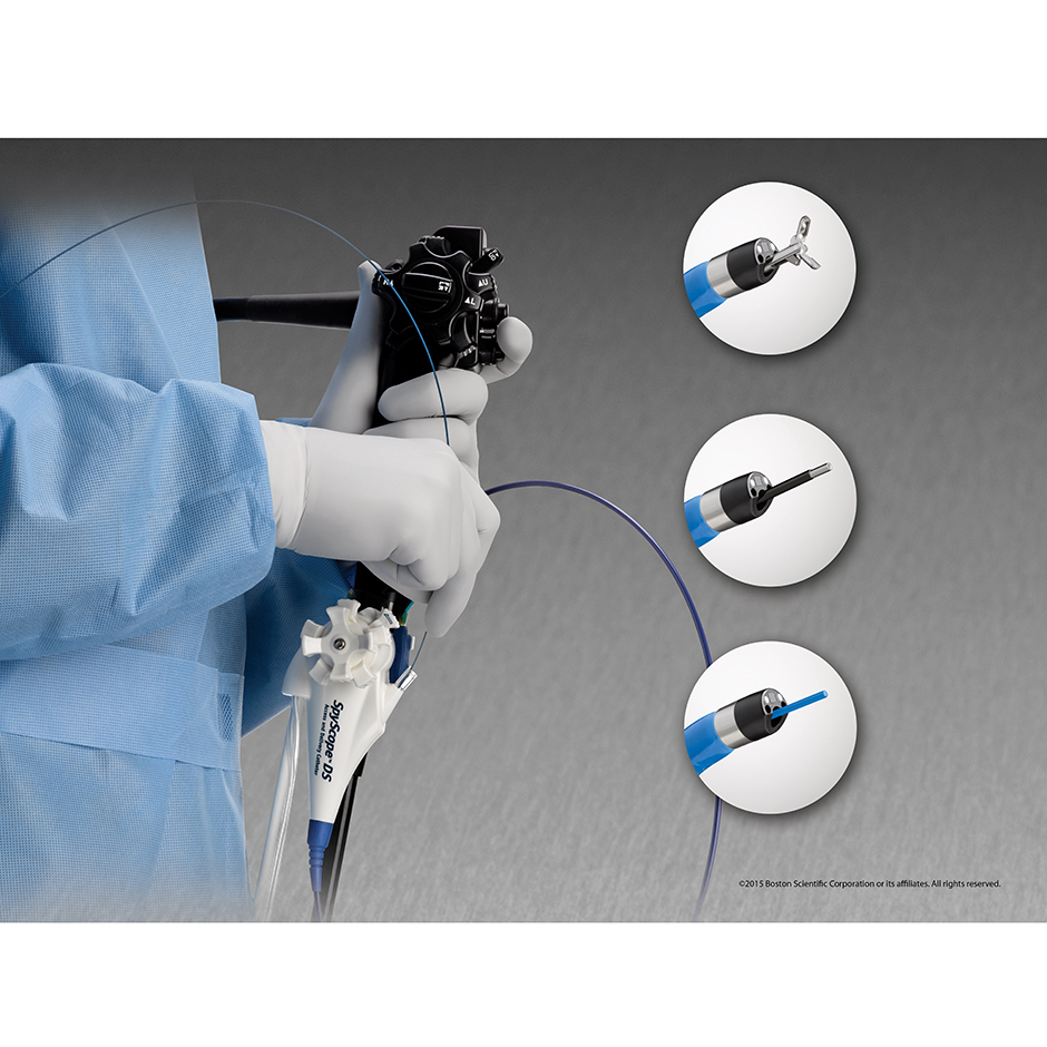 Spyglass DS II single operator use for diagnostic and therapeutic procedures.