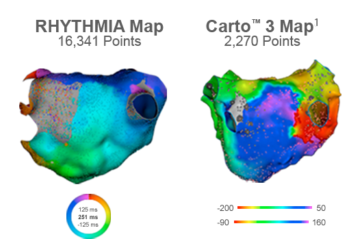 In one study, the RHYTHMIA HDx mapping system generated 16,341 points compared to 2,270 points generated by Carto® 3.5