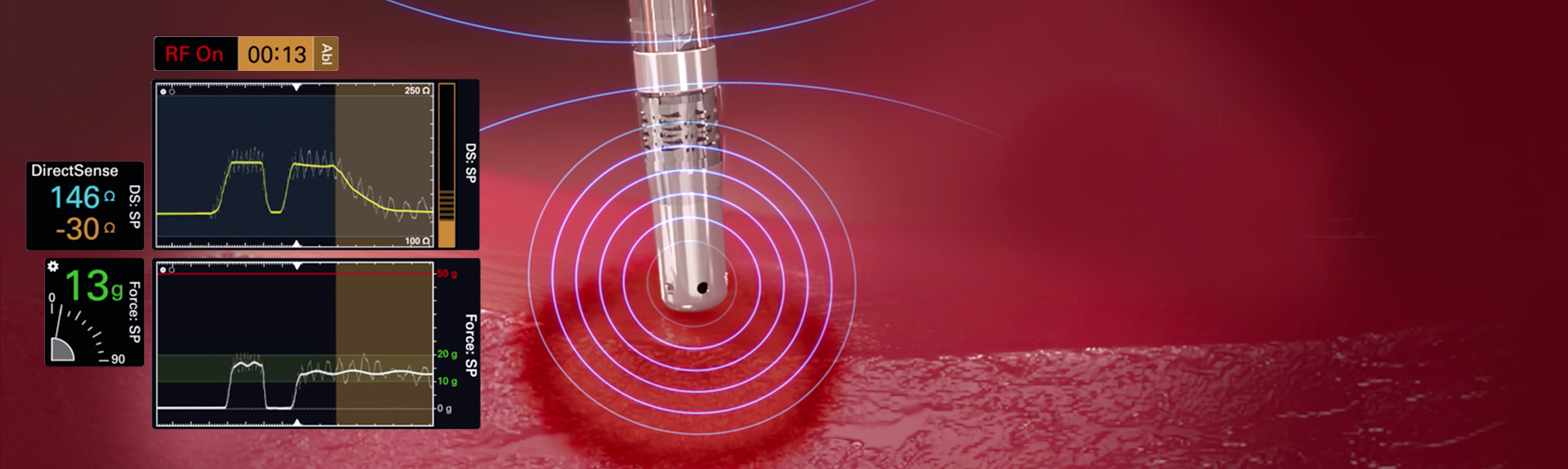 Monitor Subsurface Tissue Heating