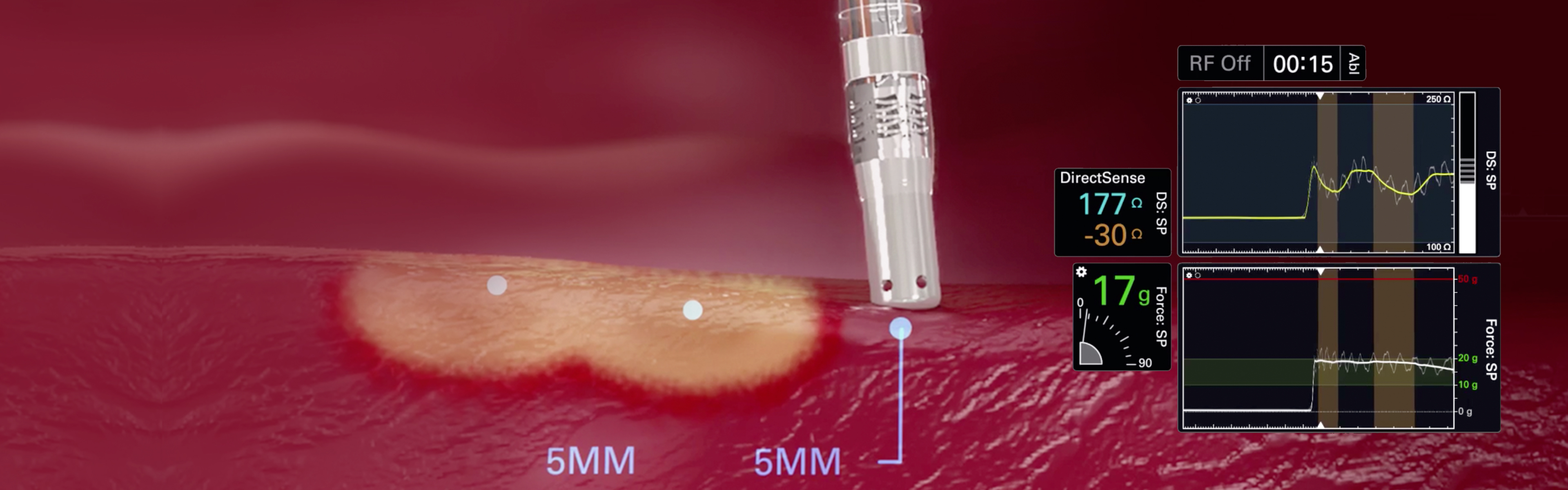 Deliver Predictable and Controlled RF