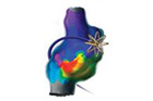 thumb_Rhythmia_Mapping_System_with_heart-140x140.jpg