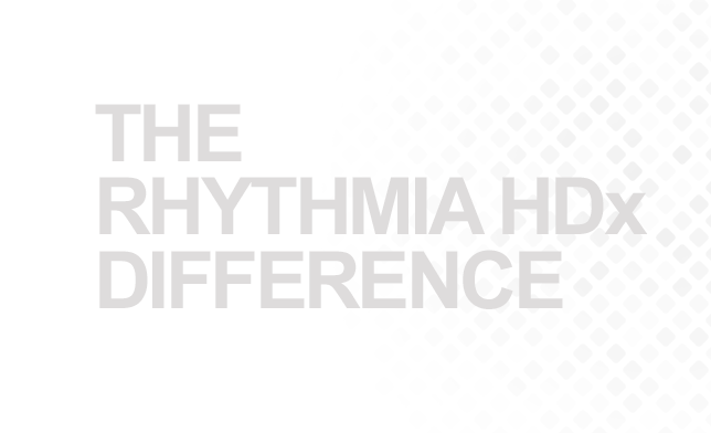 The RHYTHMIA HDx difference
