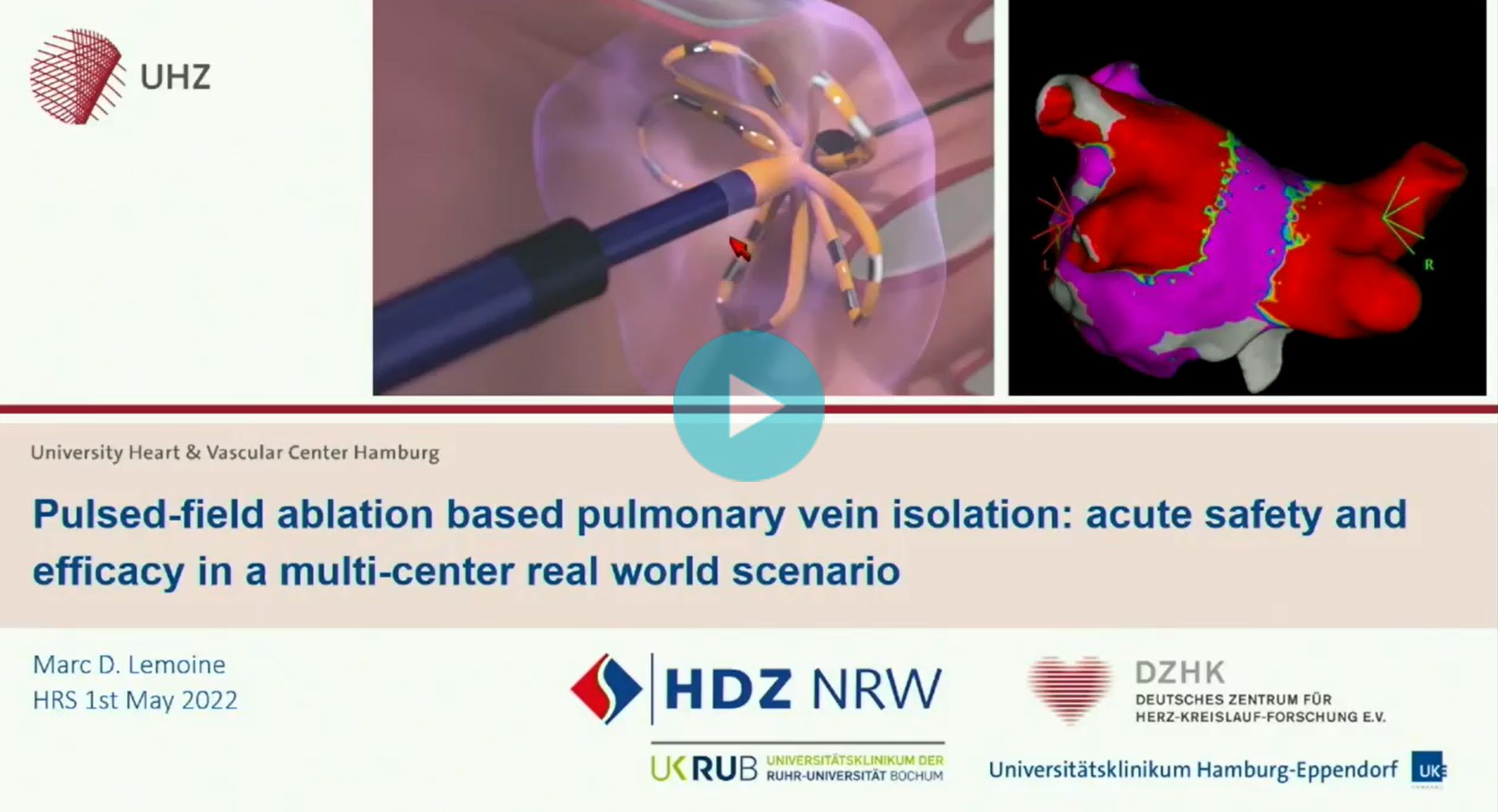 Pulsed-field ablation based PVI: Acute Safety and Efficacy in a Multi-center Real-world Scenario