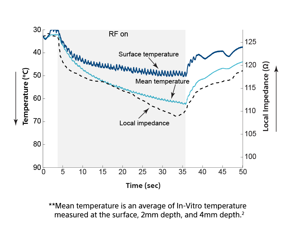 Chart showing the correlation between temperature and local impedance during RF ablation.