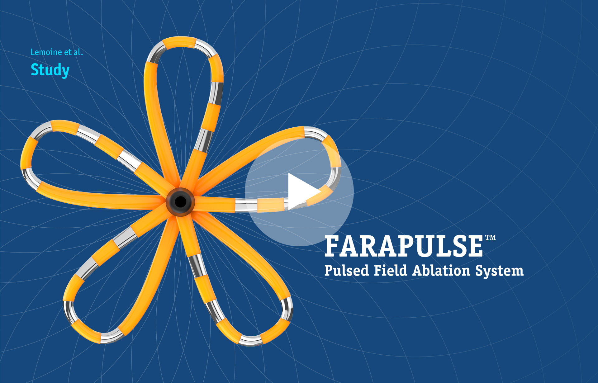 A 138-patient study on FARAPULSE PFA by Lemoine et al.
