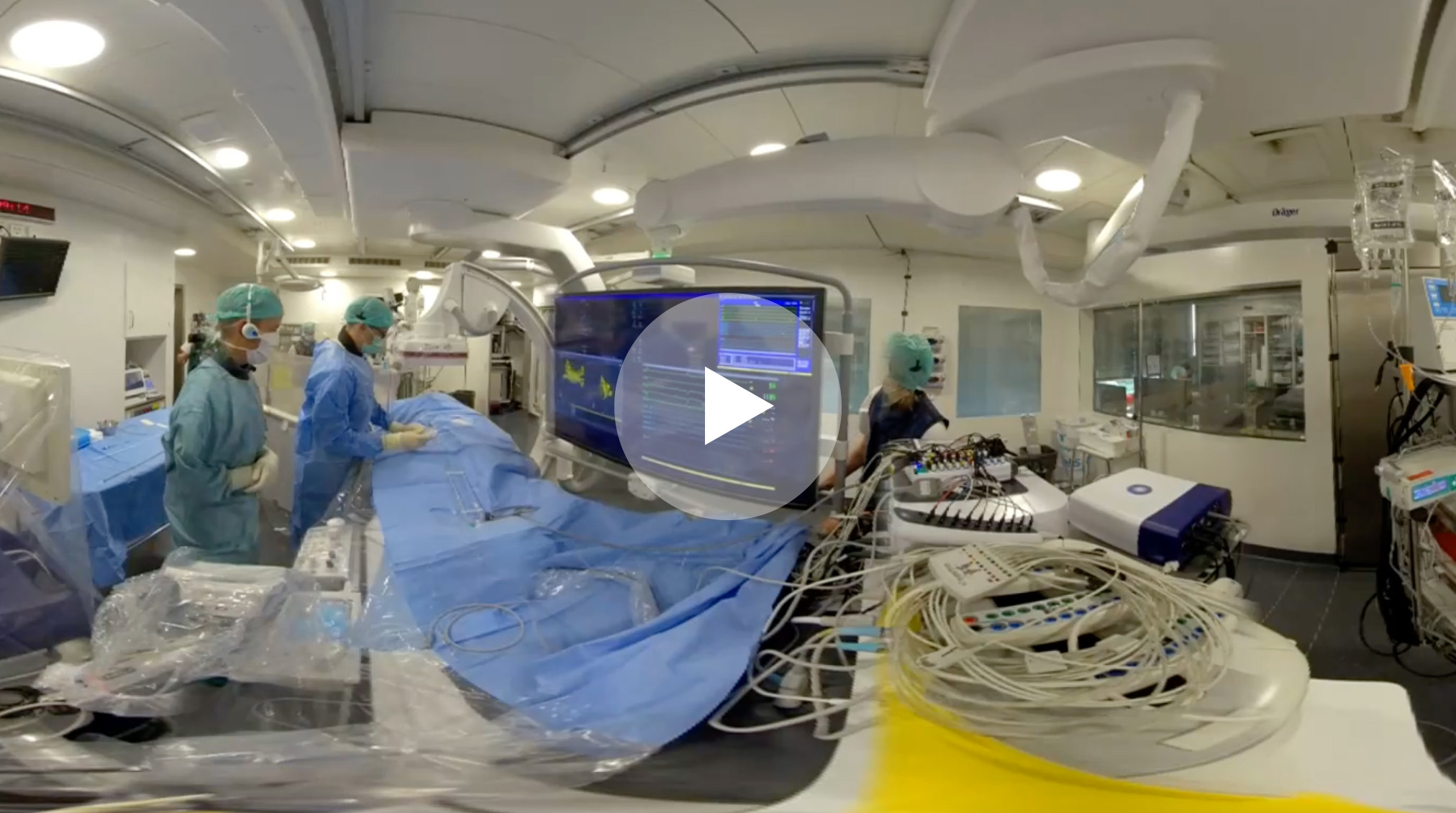 Panoramic procedure view of ablation using FARAPULSE PFA System (video thumbnail)