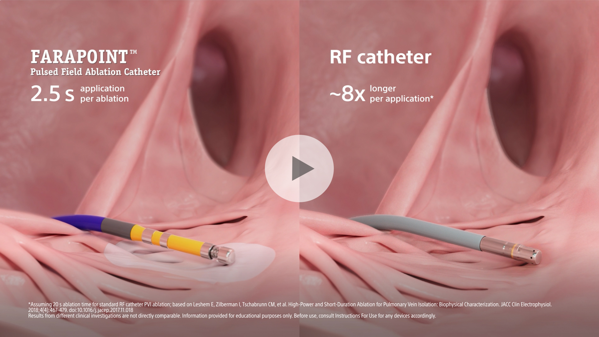 How FARAPOINT™ PFA catheter compares to RF focal catheters