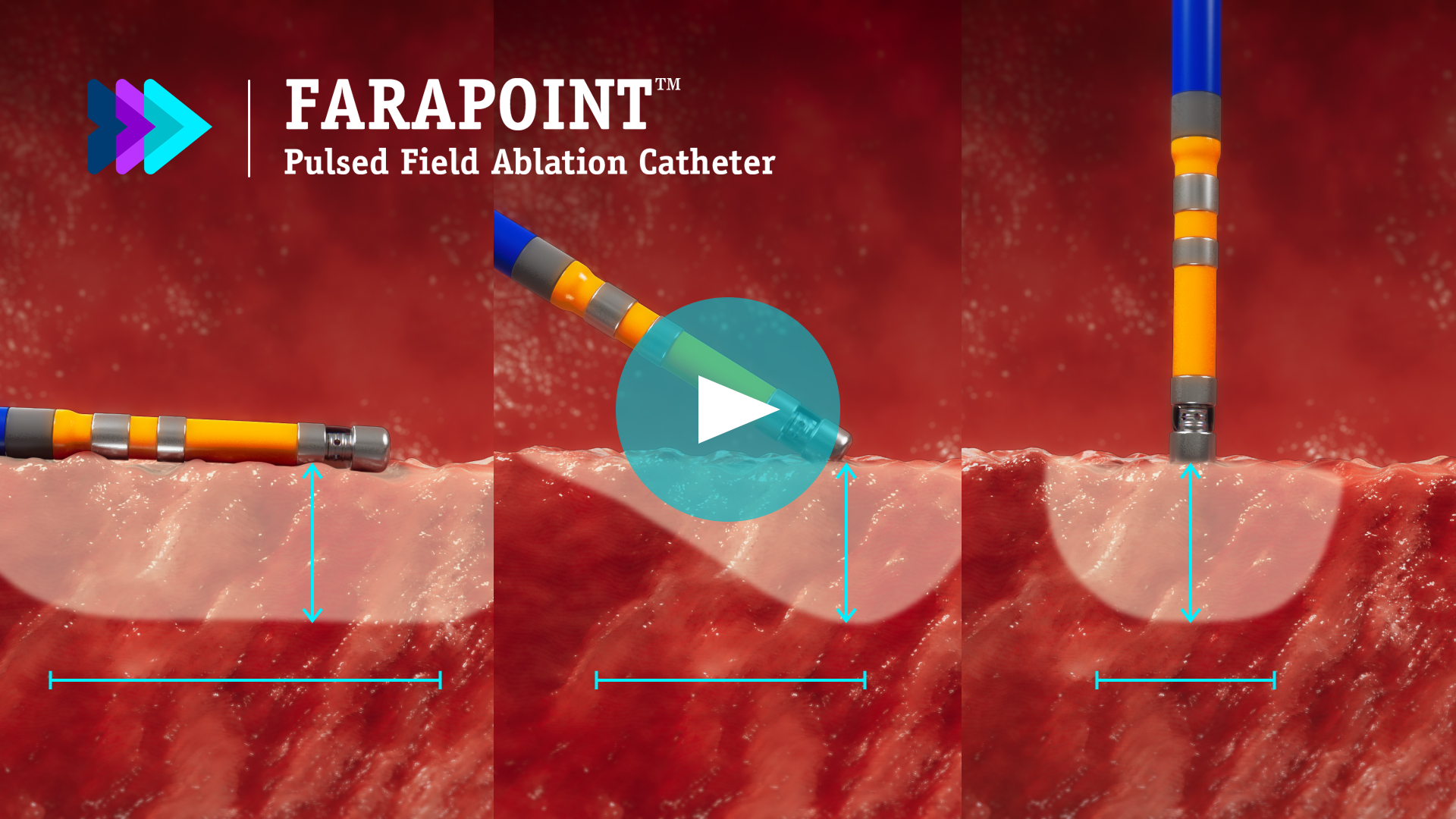 FARAPOINT Pulsed Field Ablation (PFA) Catheter creating lesions with consistent depth