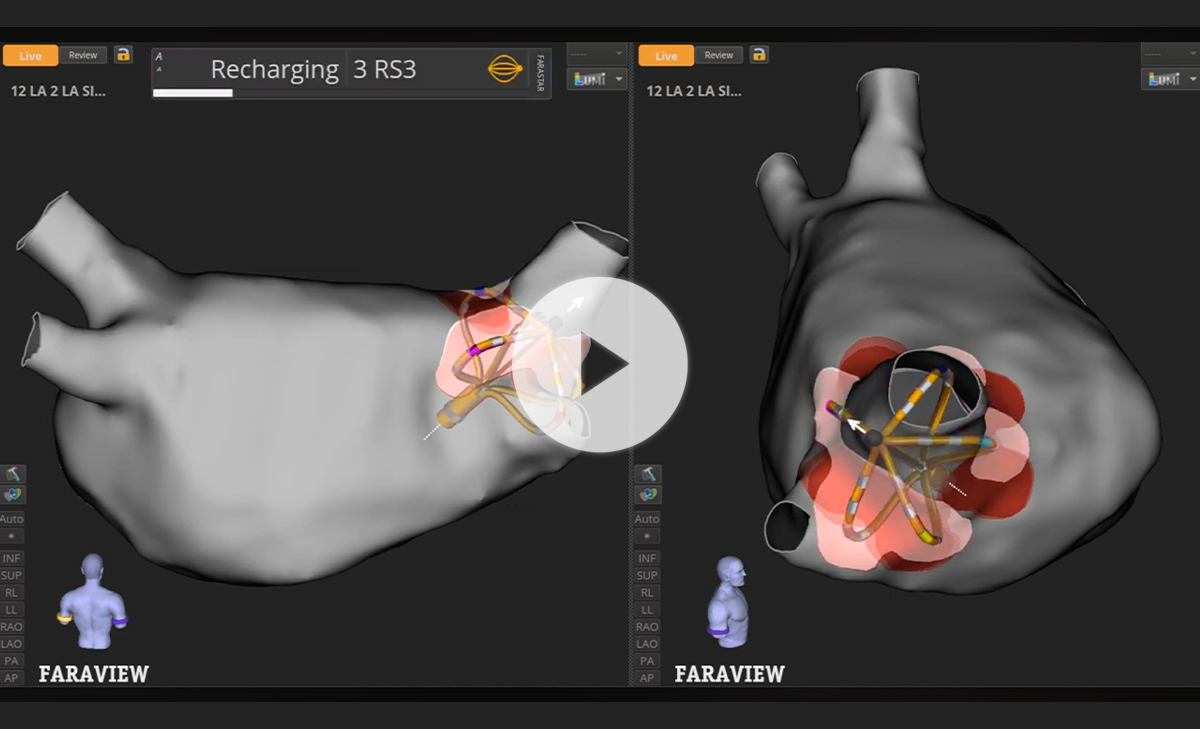 Screen showing automated FIELDTAG™ and FARAVIEW technology.