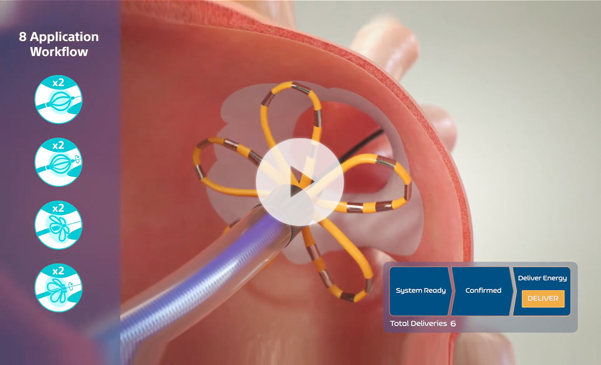 FARAWAVE energy visualized ablating cardiomyocytes while sparing tissue.
