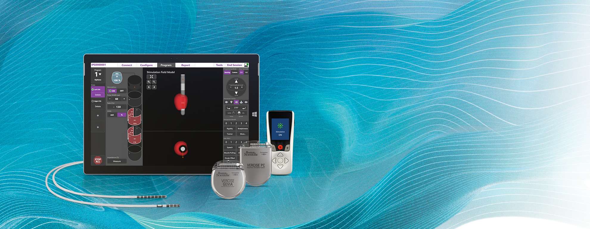 Vercise Directional DBS Systems