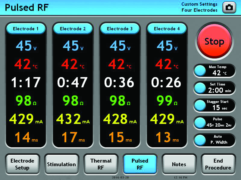 G4 RF Generator touch screen