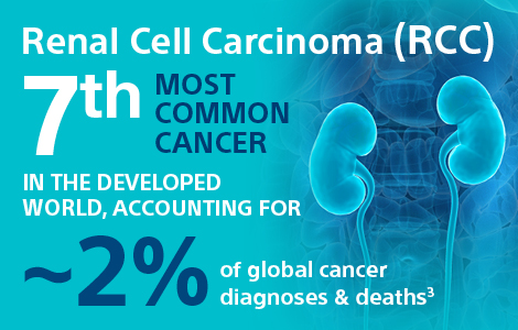 renal cell carcinoma incidence