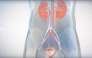 View the Ureteral Stent Deployment Video