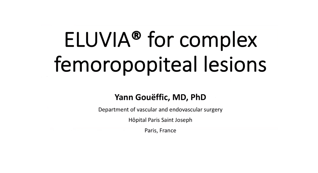 complex femoropopiteal lesions