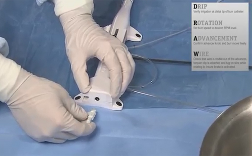 The Peripheral Rotablator™ Rotational Atherectomy System setup video