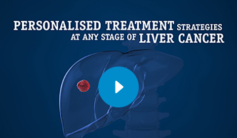 Personalised Treatment Strategies - Liver Cancer