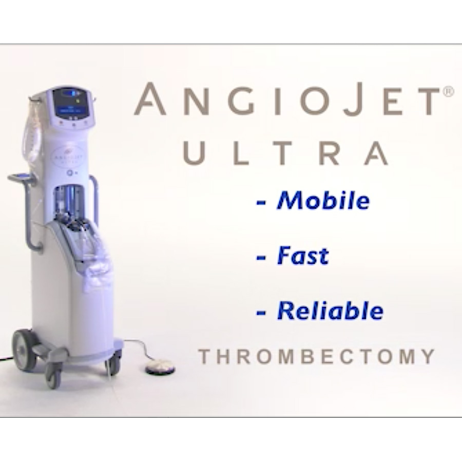 Animación de la tecnología del catéter para trombectomía Solent de AngioJet 