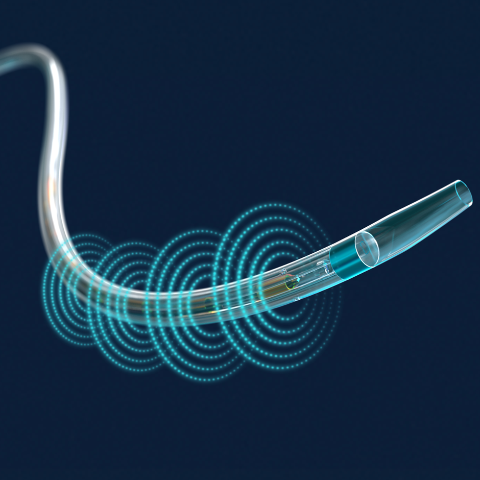 The targeted ultrasound waves differentiate this technology, providing accelerated clot dissolution by unwinding the fibrin matrix.