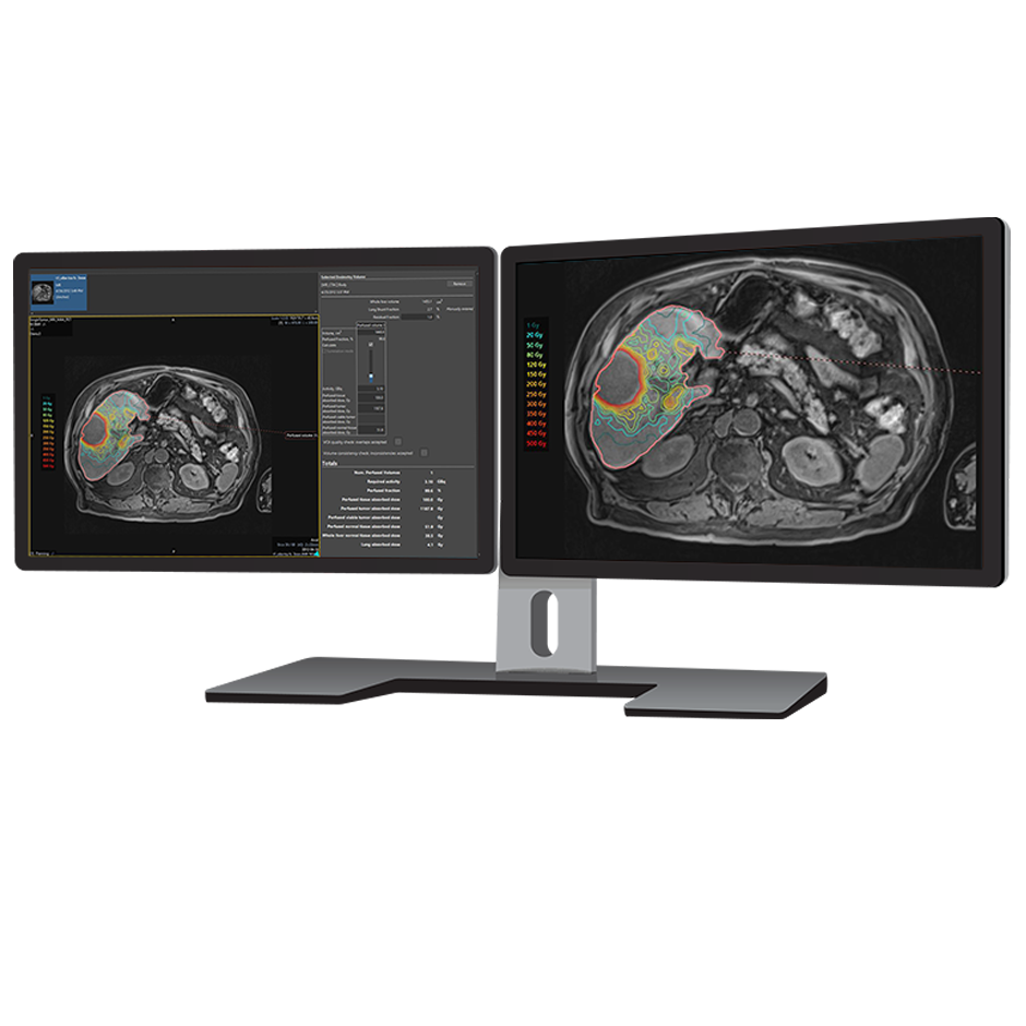 Simplicit90Y™ Personalized Dosimetry Software