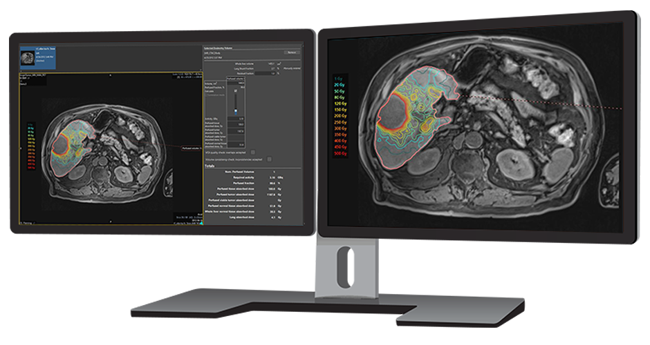 Simplicit90Y™ Personalized Dosimetry Software image.