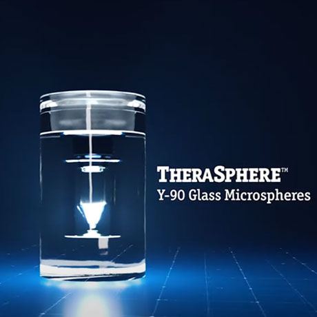 TheraSphere™ Y-90 Glass Microspheres