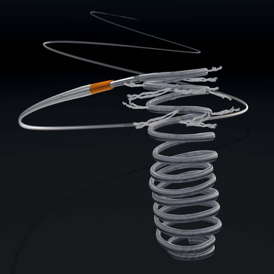 Boston Scientific Embold Detchable Coil System with a microcatheter against a black background.
