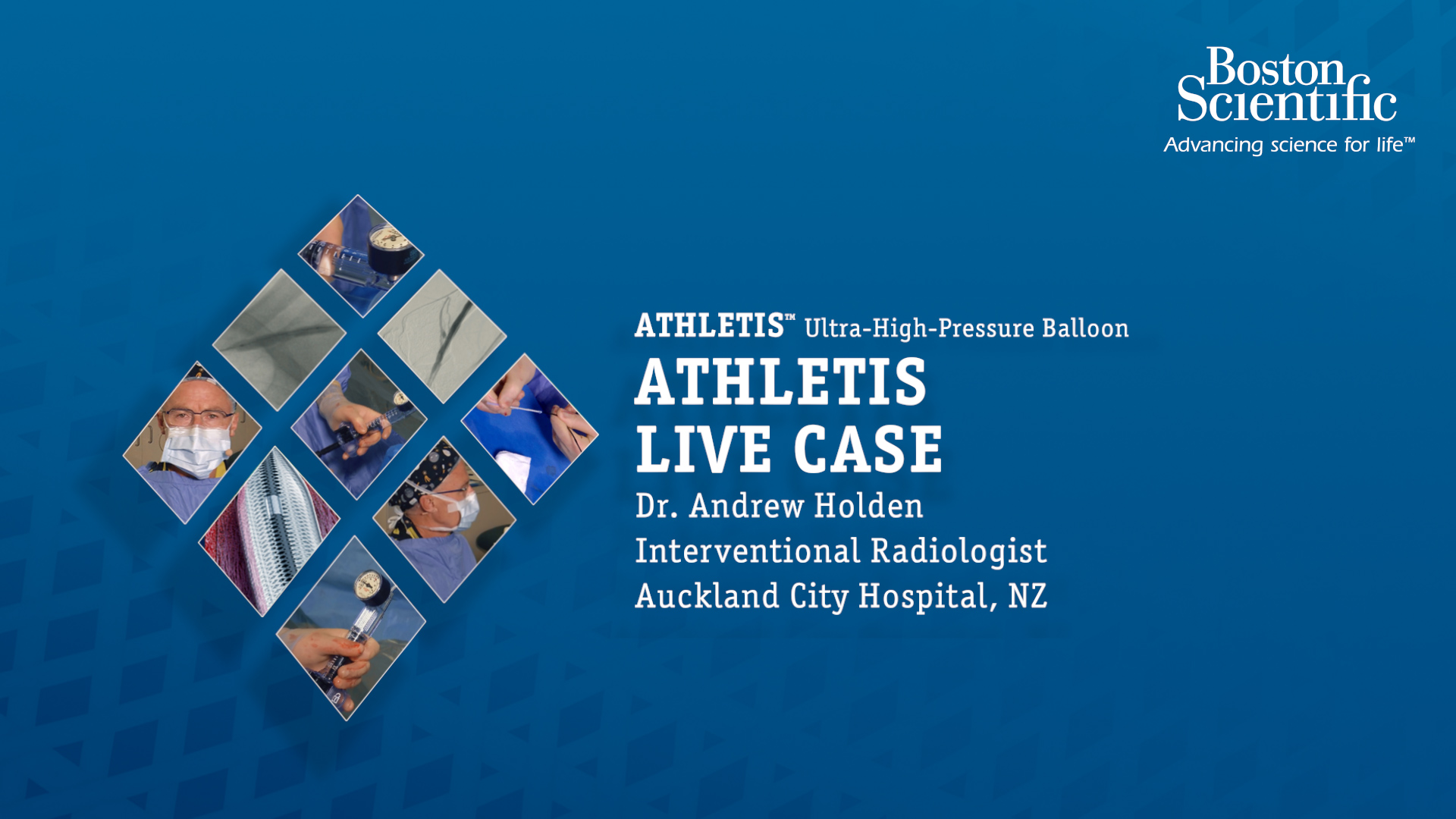 Access the AV fistula recorded case by Dr. Andrew Holden using Athletis™ for the first time