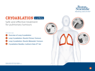 Cryoablation Lung