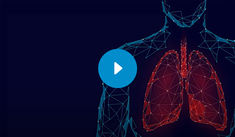 Educare Pulmonary Embolism Learning Programme Video