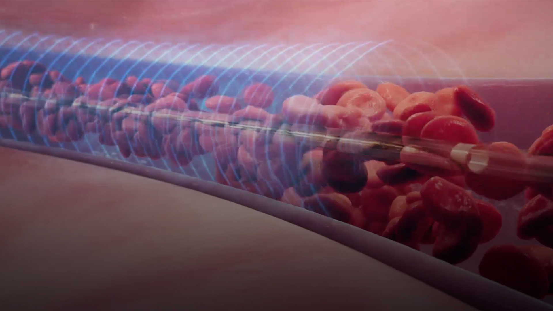 Mechanism of action Video