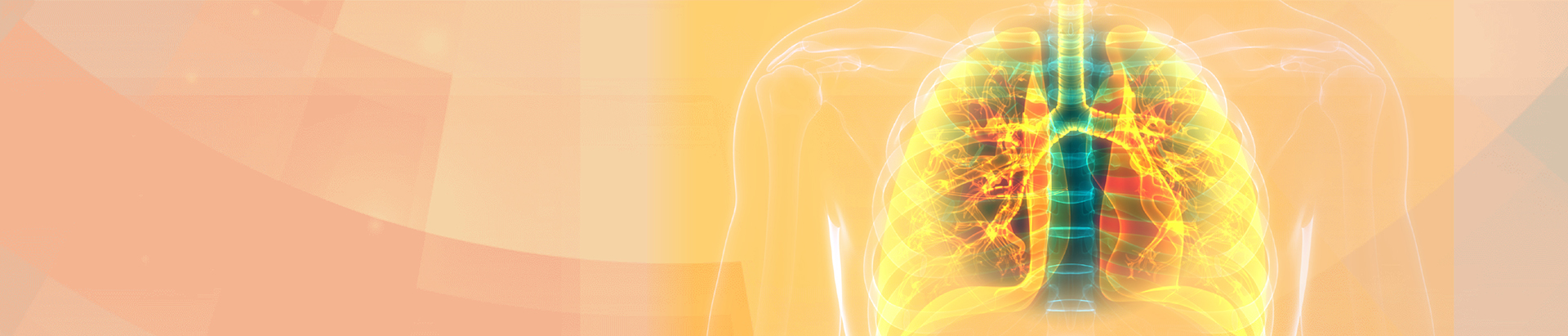 Pulmonary Embolism - Disease Overview