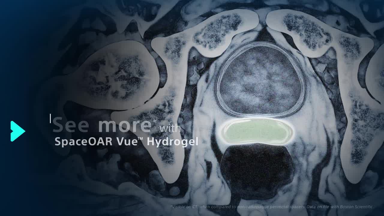 See more with SpaceOAR Vue