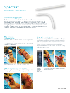 Spectra™ Concealable Penile Prosthesis Step by Step