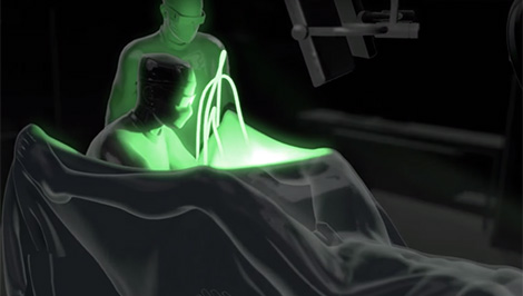 Animação sobre a terapia com laser GreenLight