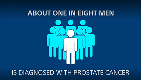 Prostate Cancer Treatment Options video.