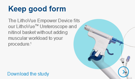 Keep good form - The LithoVue Empower Device fits our LithoVue™ Ureteroscope and nitinol basket without adding muscular workload to your procedure.1